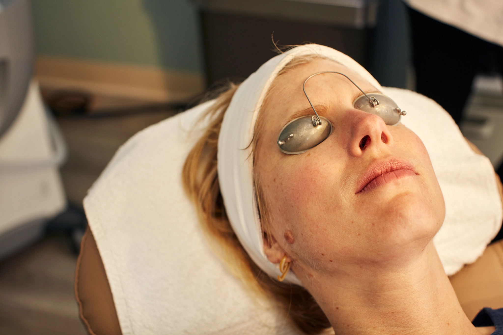 Facial Peels 101: Which Types Work Best on Older Skin?