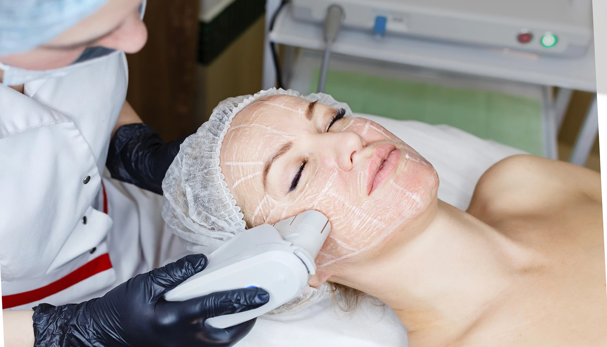 A photo of a woman undergoing an ultherapy treatment.
