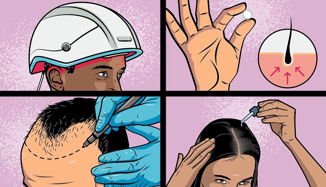 advanced hair regrowth methods A detailed illustration of hair restoration procedures, showcasing the steps involved in revitalizing hair
