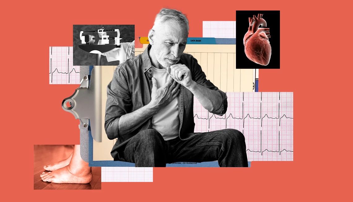 Signs of Heart Failure collage of symptoms of heart failure