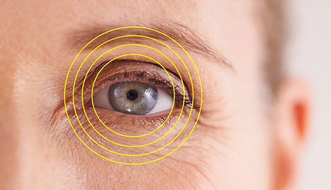 Conditions That Could Disqualify You For LASIK yellow circles around an eye