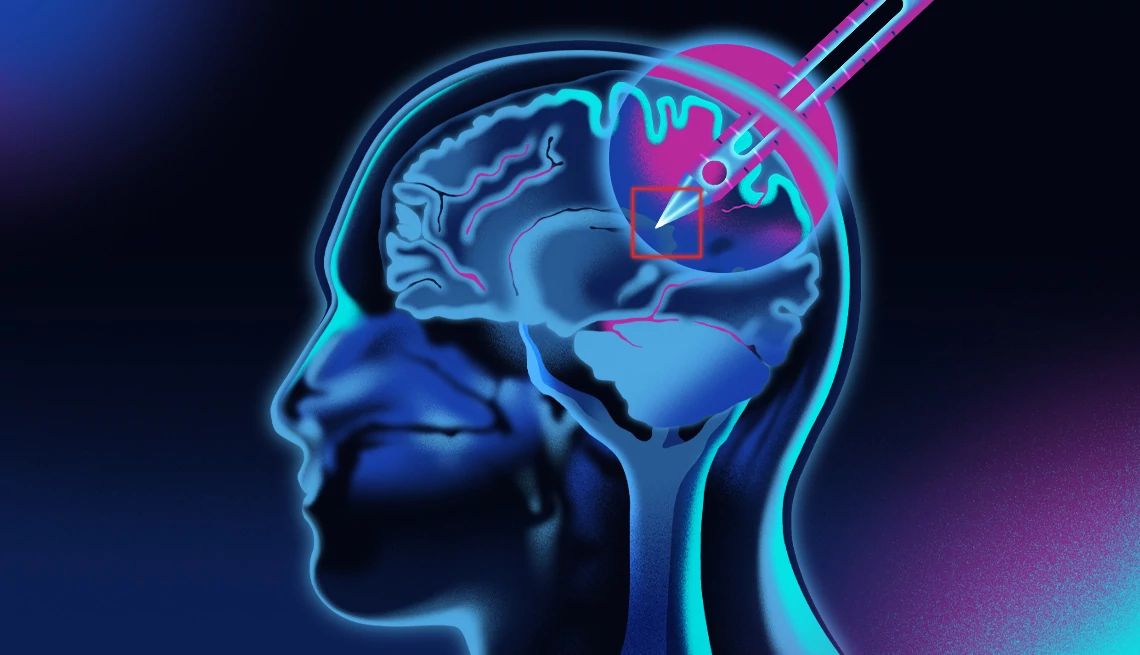 Ilustración de un cerebro