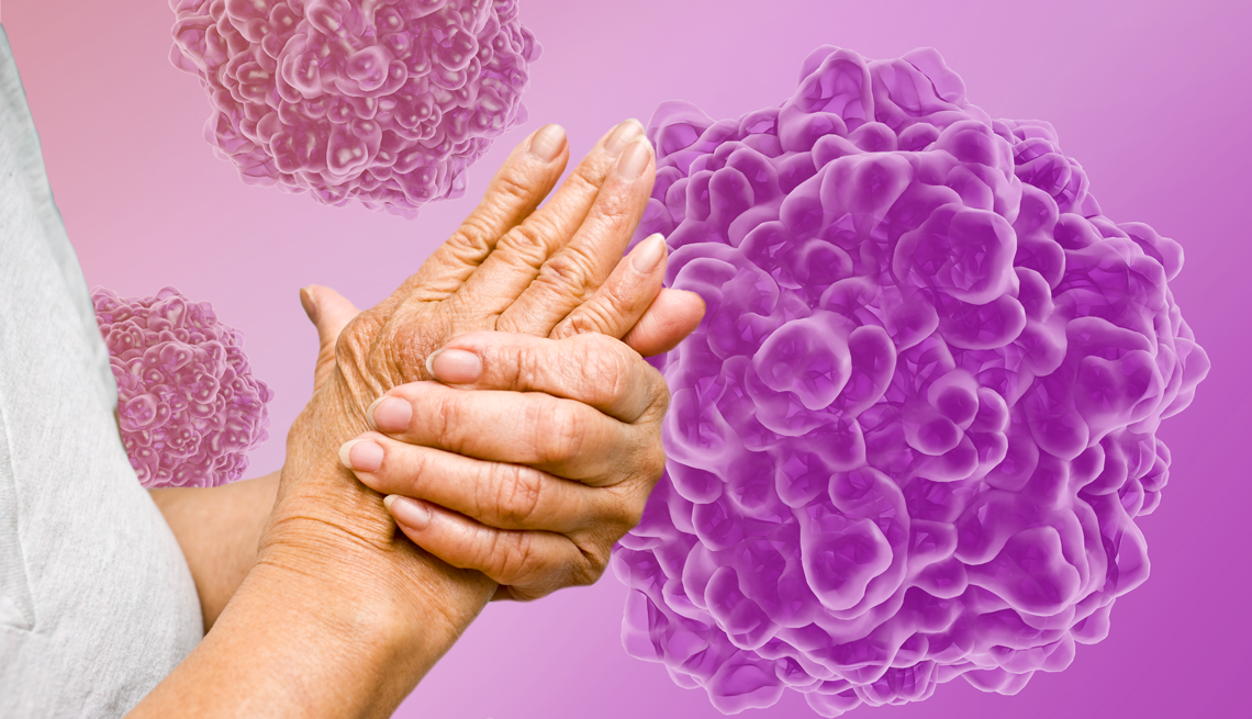 Parvovirus B19 Cases Rising in U.S. a woman rubbing her hands together with parvovirus b19 on a pink background