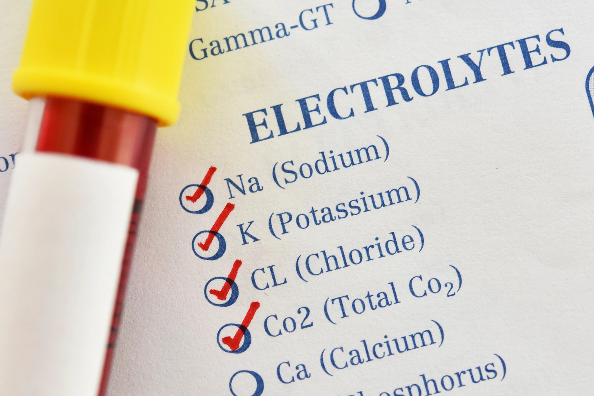 an electrolyte test list showing sodium, potassium, chloride, total CO2 and calcium