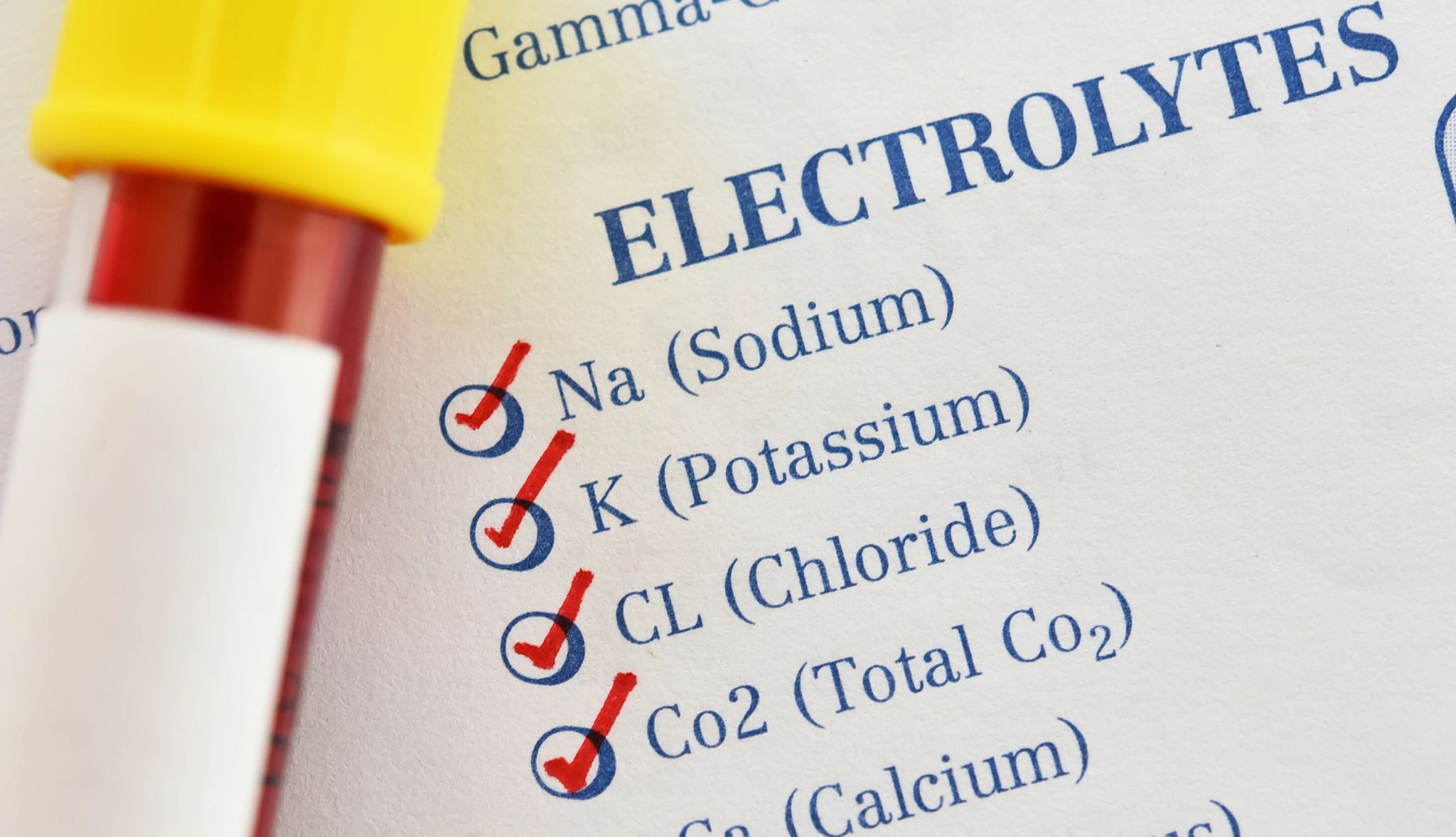 Sodium Lab Test AARP's Smart Guide to Understanding Lab Work Results