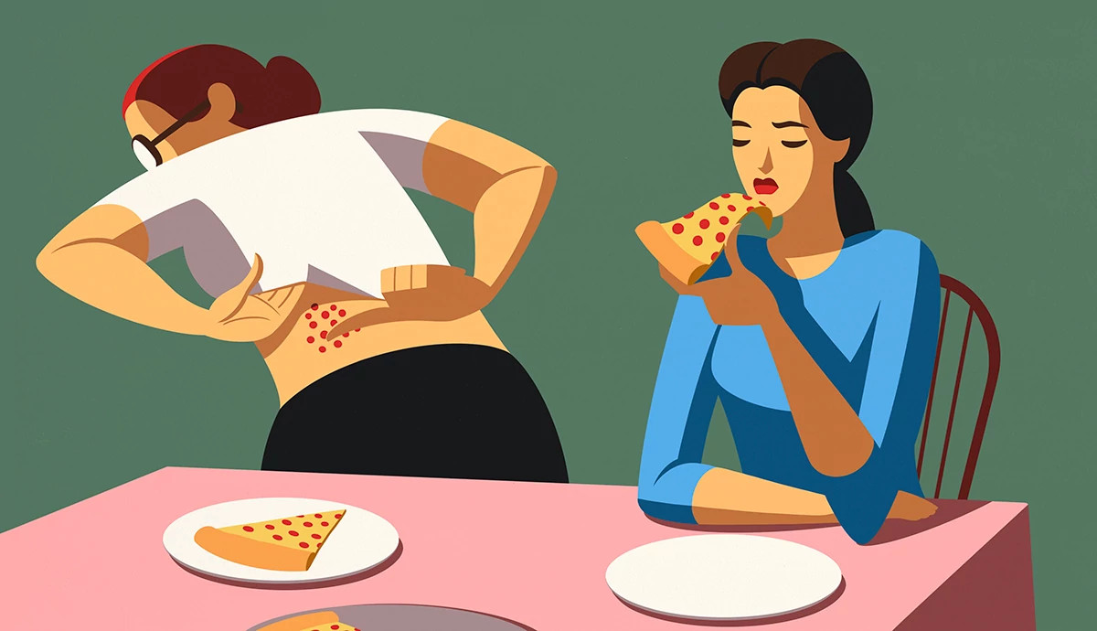 an illustration shows a person looking uncomfortable while sitting at a table holding a slice of pizza, while another person shows a rash on their back that looks similar to the pizza
