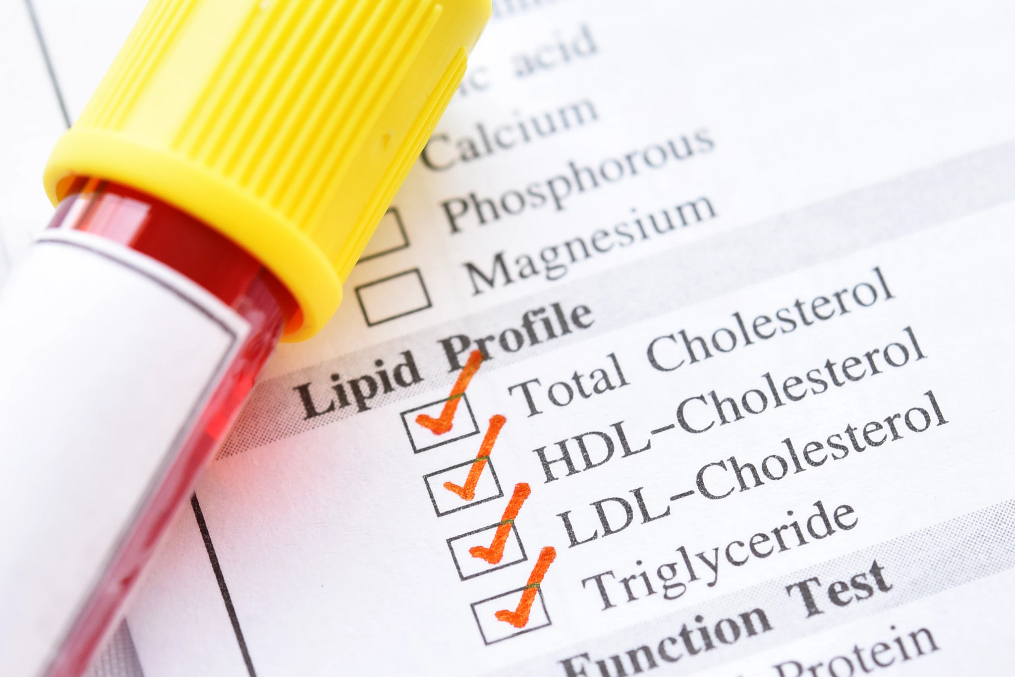 lipid profile test list listing total cholestrol, HDL, LDL, and triglyceride