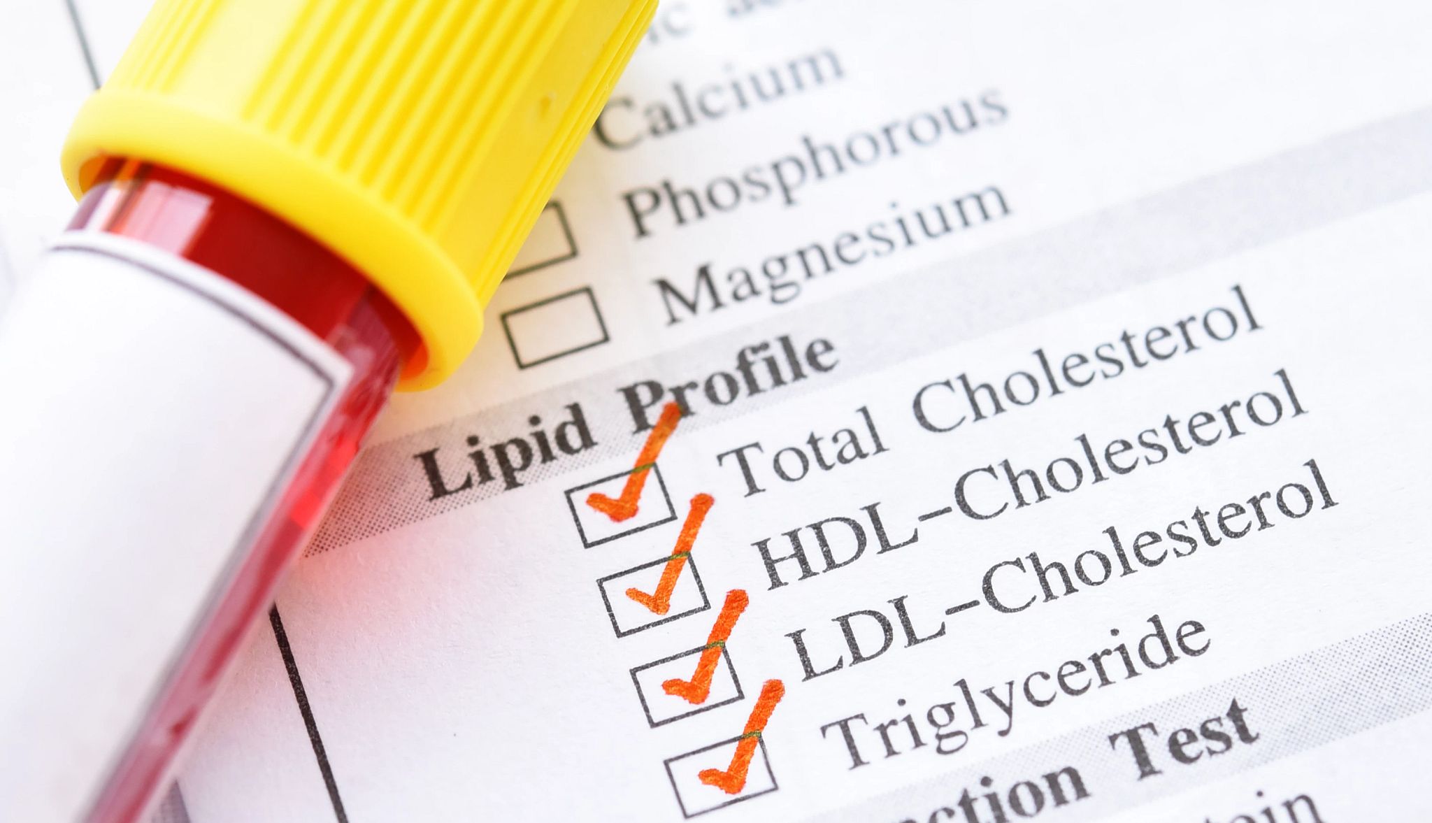 Ldl Lab AARP's Smart Guide to Understanding Lab Work Results