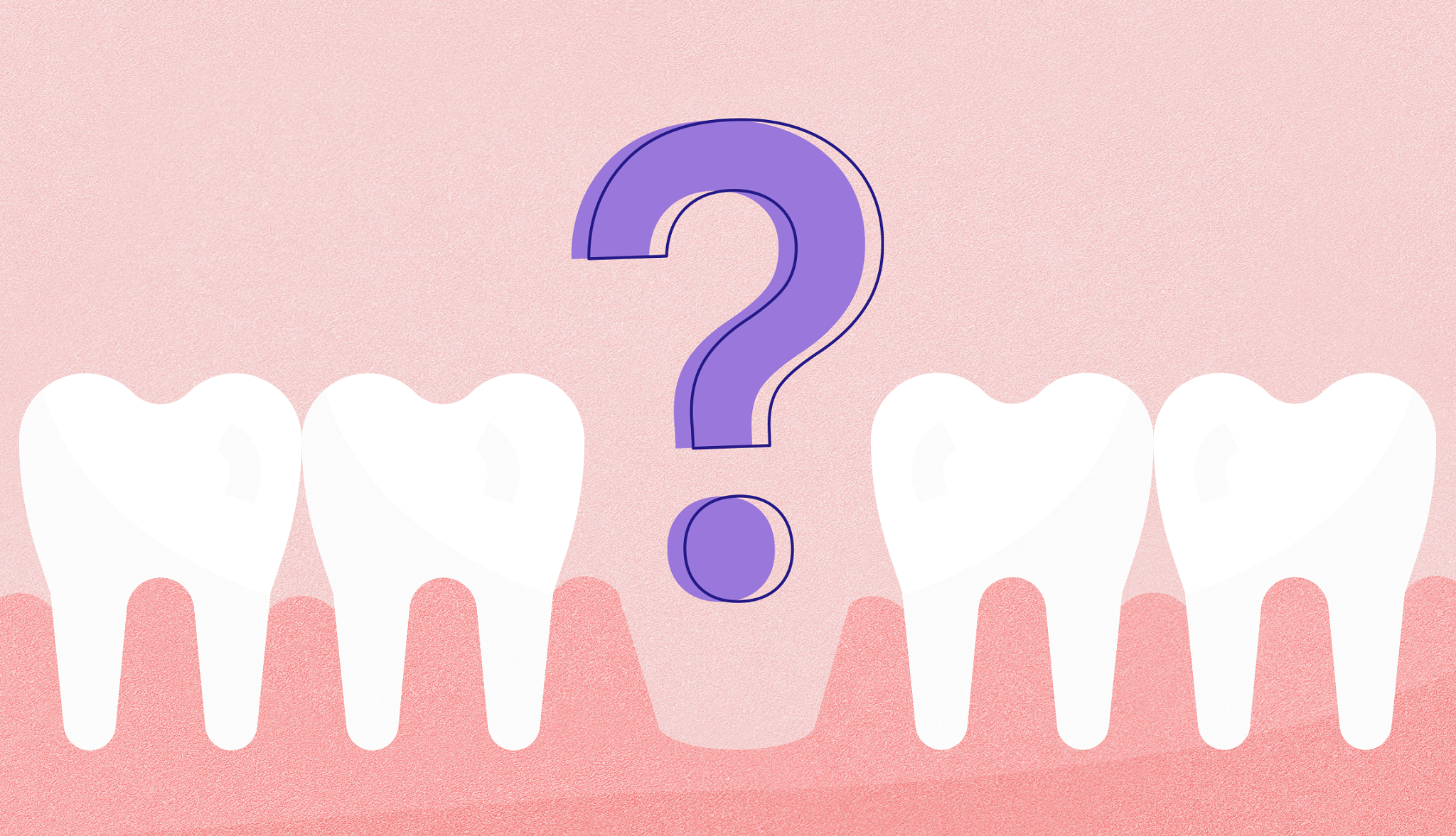 illustration of a row of teeth with a question mark in the middle 