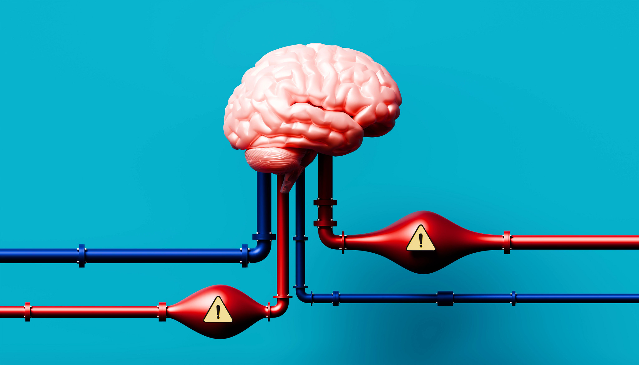 A conceptual floating brain with pipe-like arteries and warning bulges representing stroke risk.