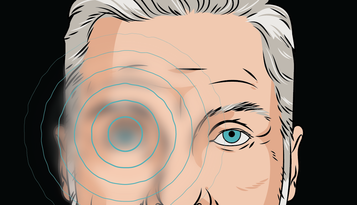 Bad Vision Examples What Causes Blurry Vision in One Eye?