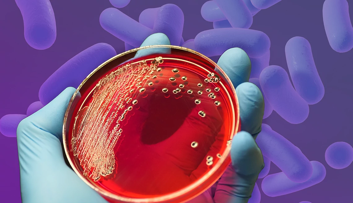 Petri Dish With Salmonella