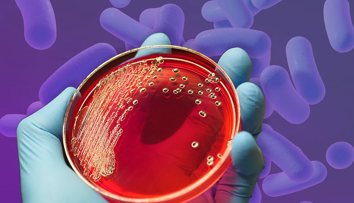 a photo collage of a gloved hand holding a petri dish with salmonella from ground beef Petri Dish With Salmonella
