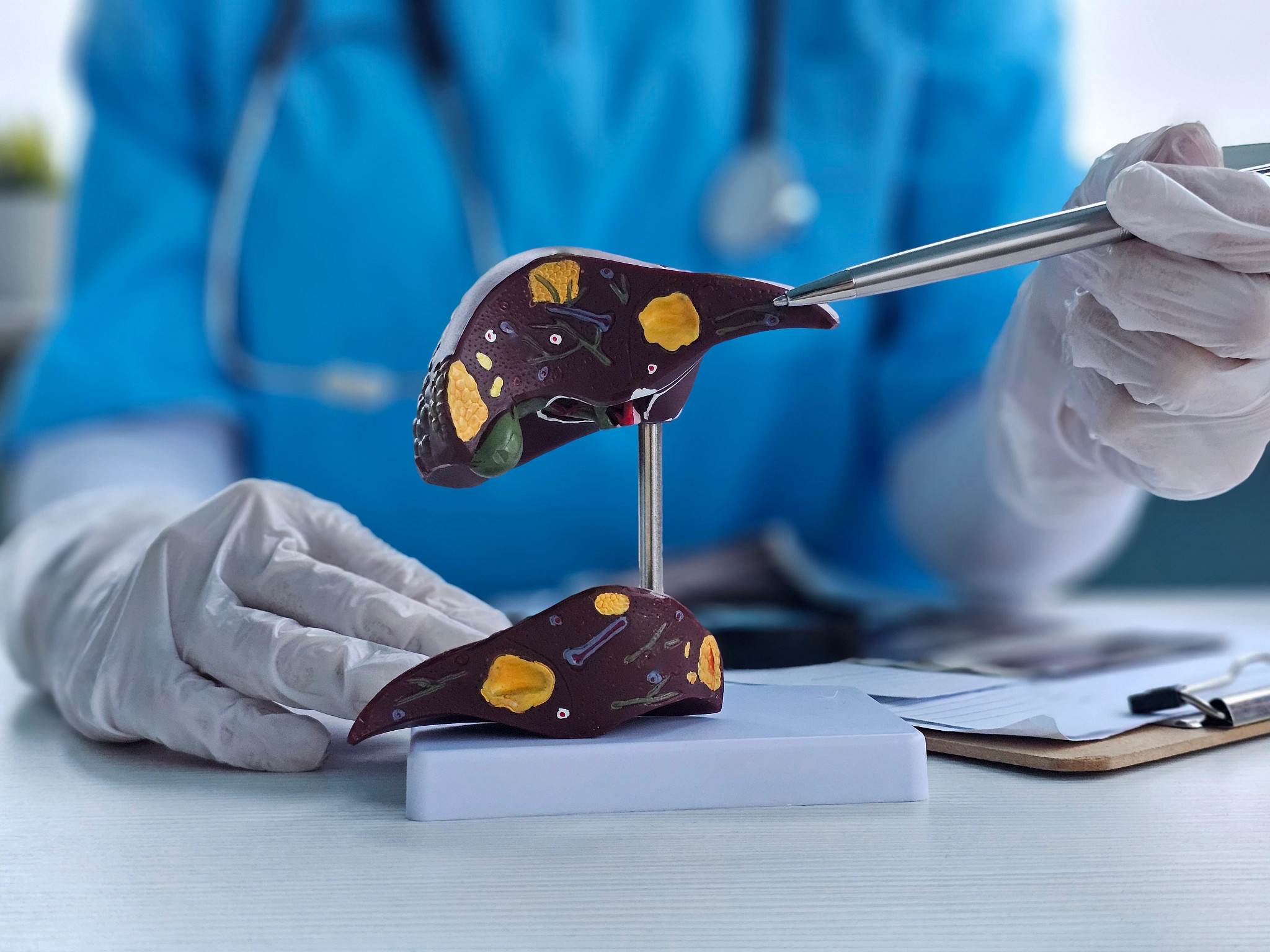 a doctor pointing to a model of the liver