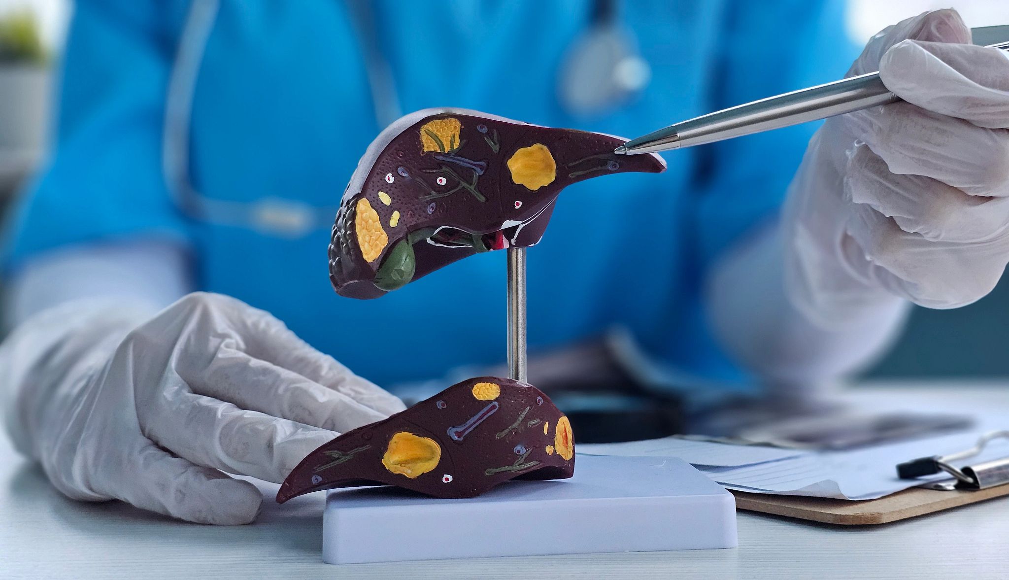 AARP's Smart Guide to Understanding Lab Work Results