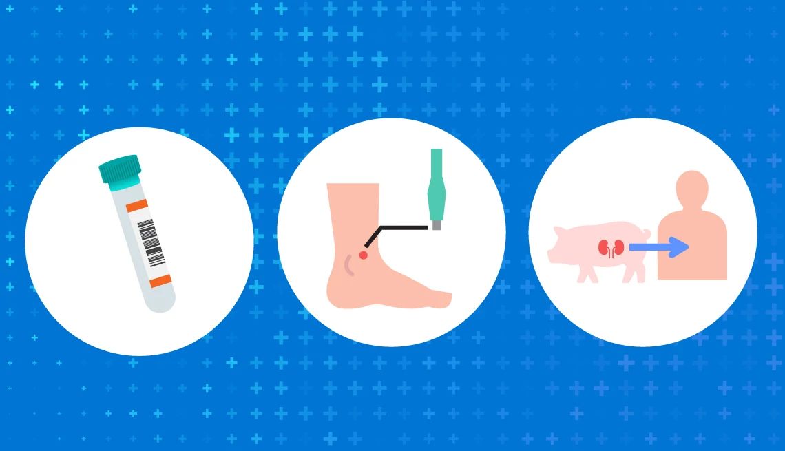 Medical Breakthroughs for Older Adults an illustration collage with a vial, a foot, and a pig kidney transplant