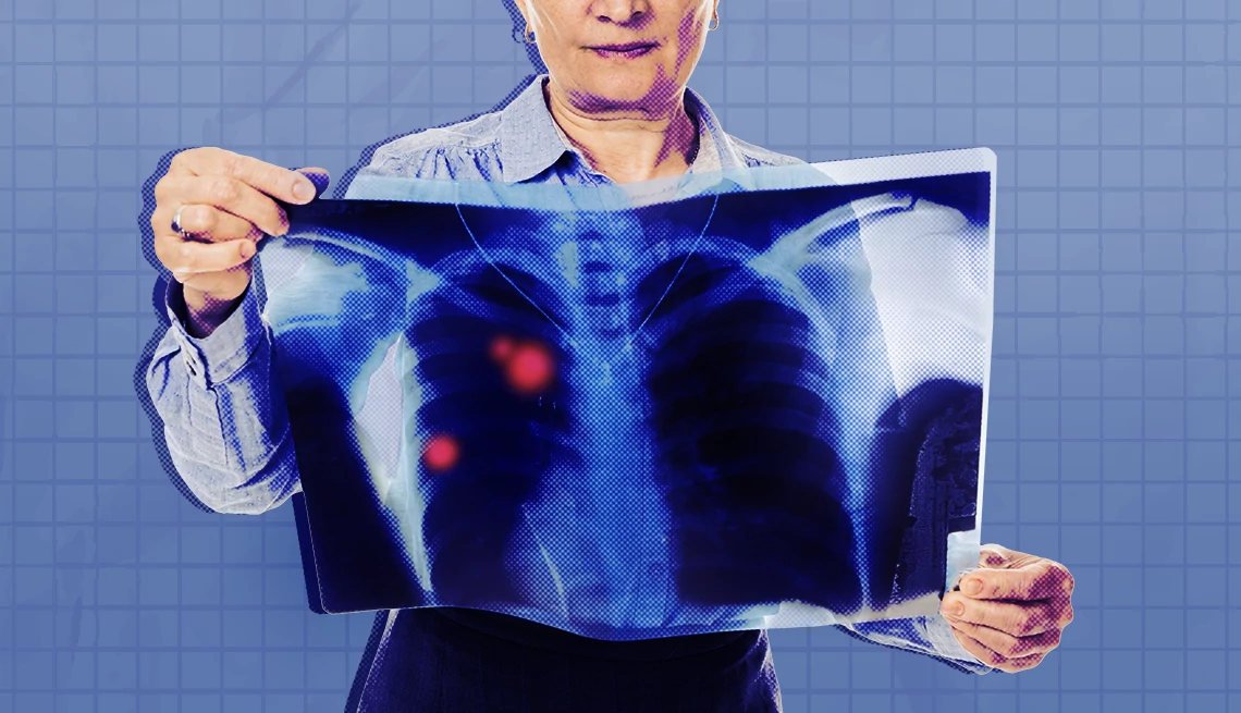 American Cancer Society Report person examining cancer scan