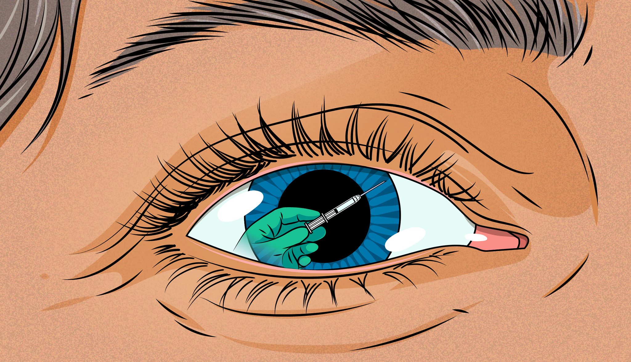 Eye Injection Needle What Do Eye Injections Feel Like?