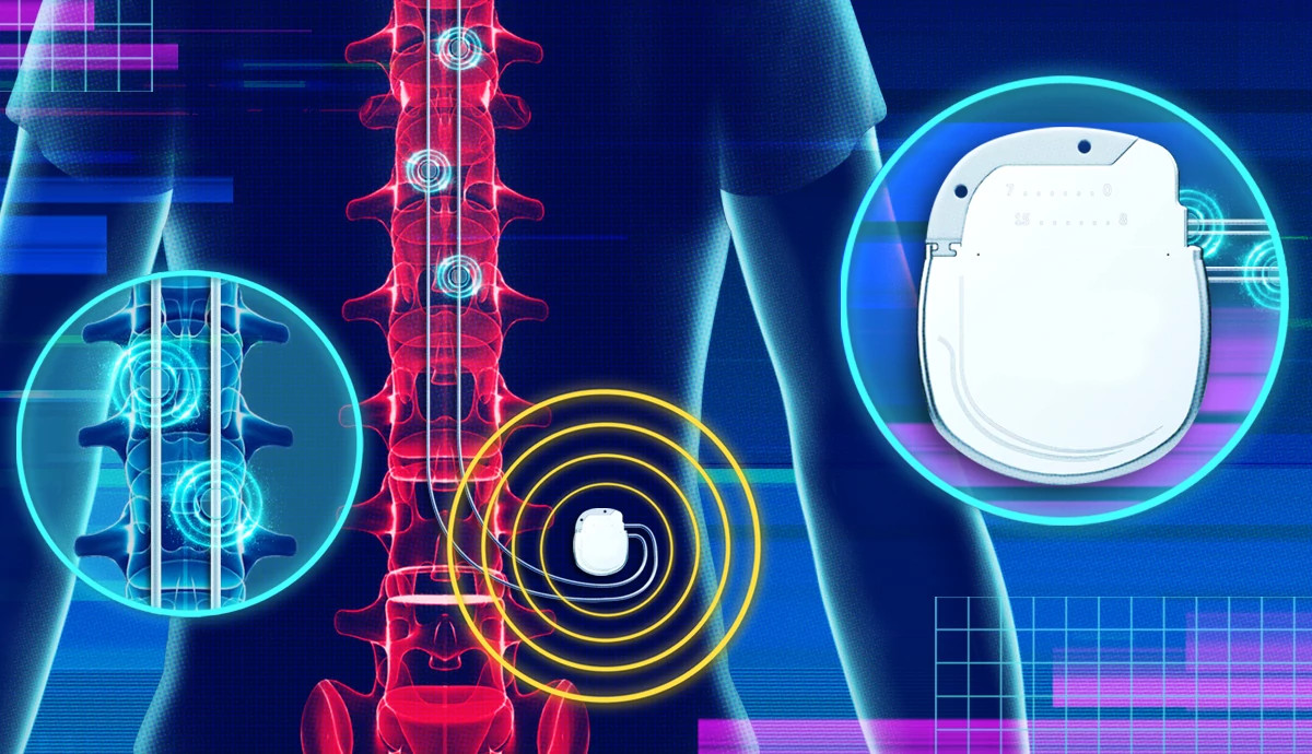 Medical Breakthroughs for Back Pain
