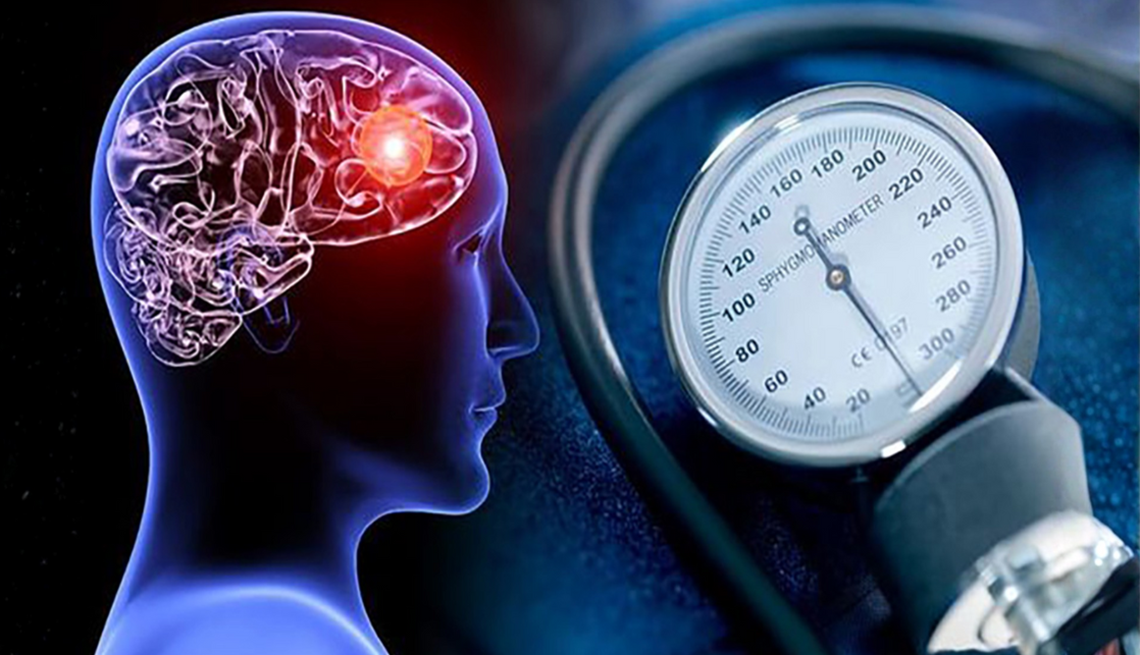 Controlling blood pressure early may be critical for maintaining cognitive function and reducing dementia risk A graphic showing a brain inside a human's head and a sphygmomanometer