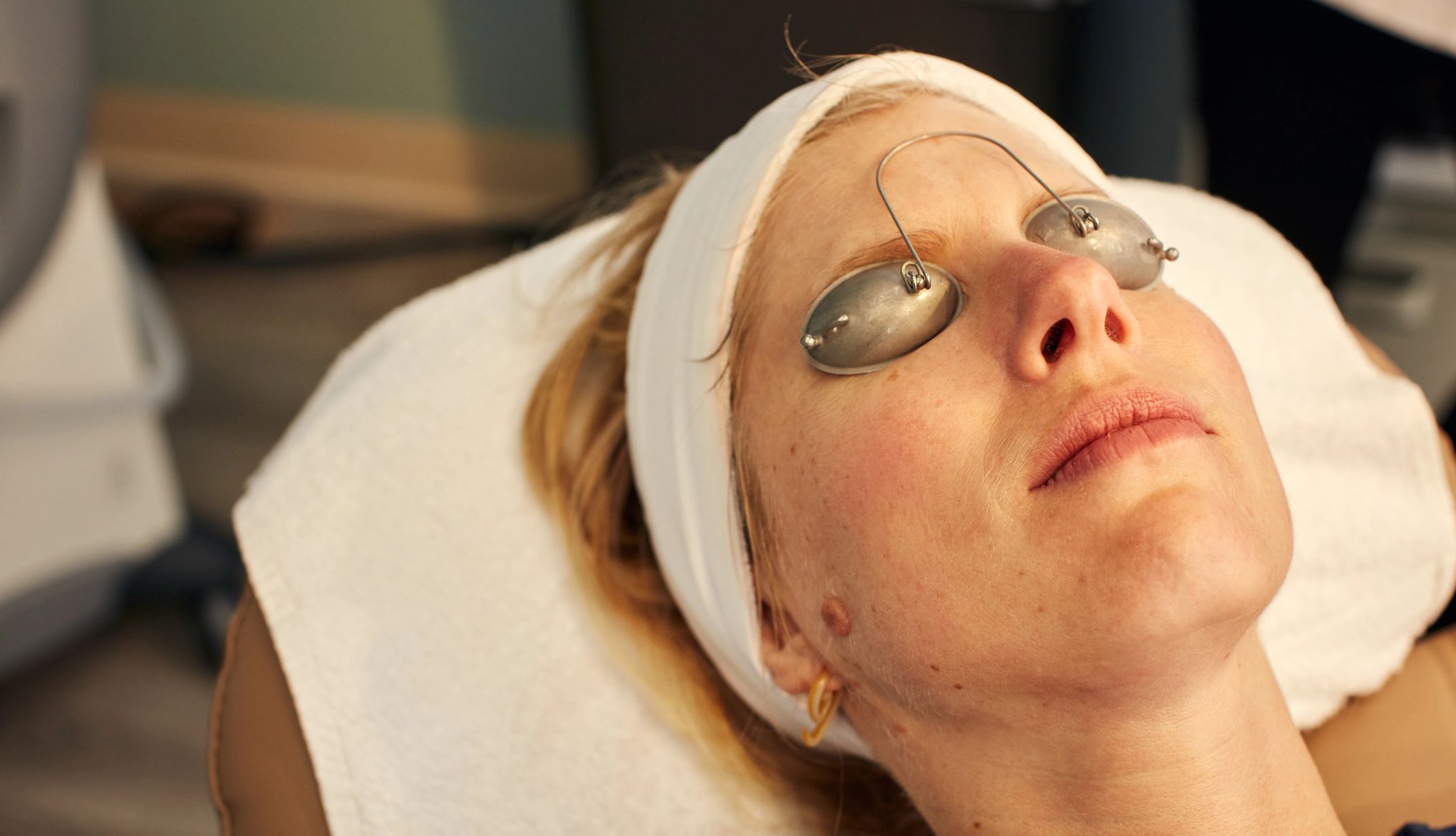Una mujer acostada con los ojos cubiertos recibe una exfoliación química