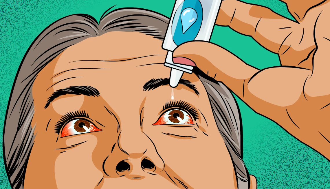 a woman is putting drops in her eyes a woman is putting drops in her eyes