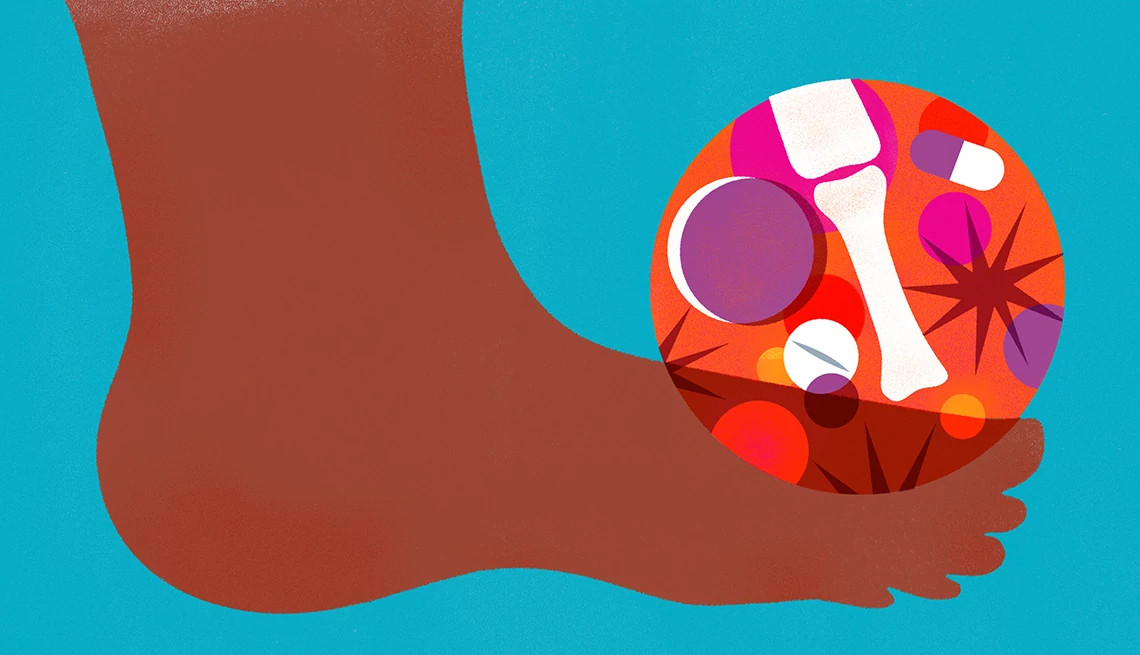 colorful, stylized illustration of a person's foot in silhouette, with a circular spotlight over the big toe joint revealing an X-ray of the bone structure surrounded by various pills and jagged star shapes representing inflammation and pain