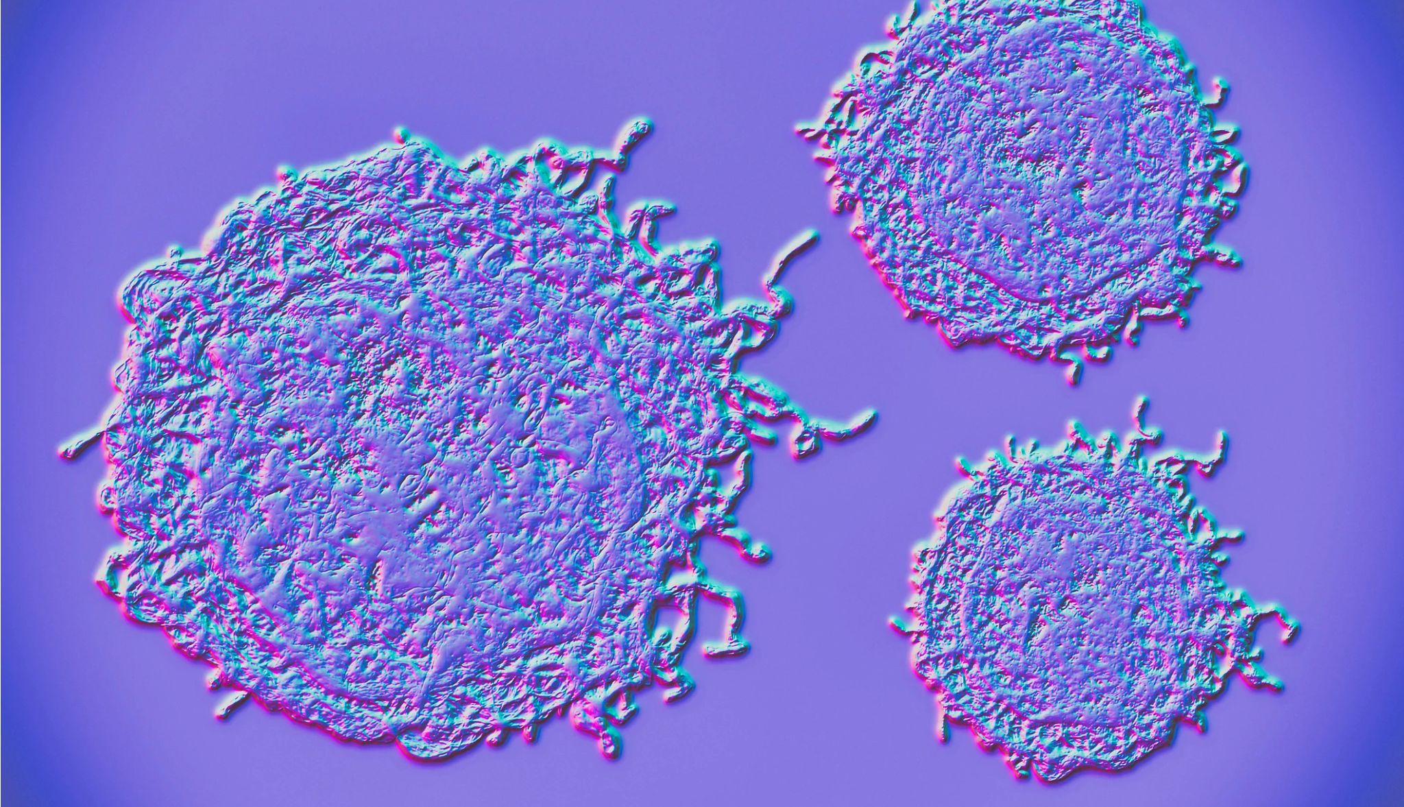 Gen Xers Face Higher Cancer Risks illustration of cancer cells