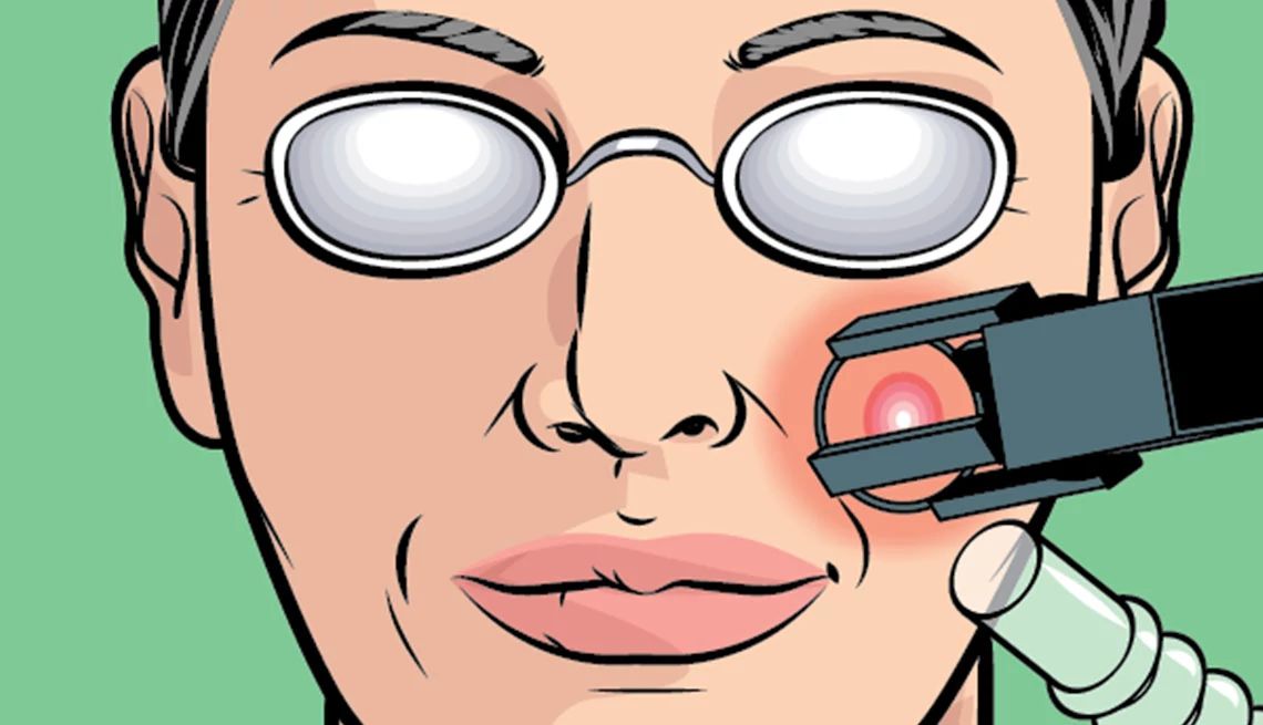 Laser resurfacing Laser resurfacing