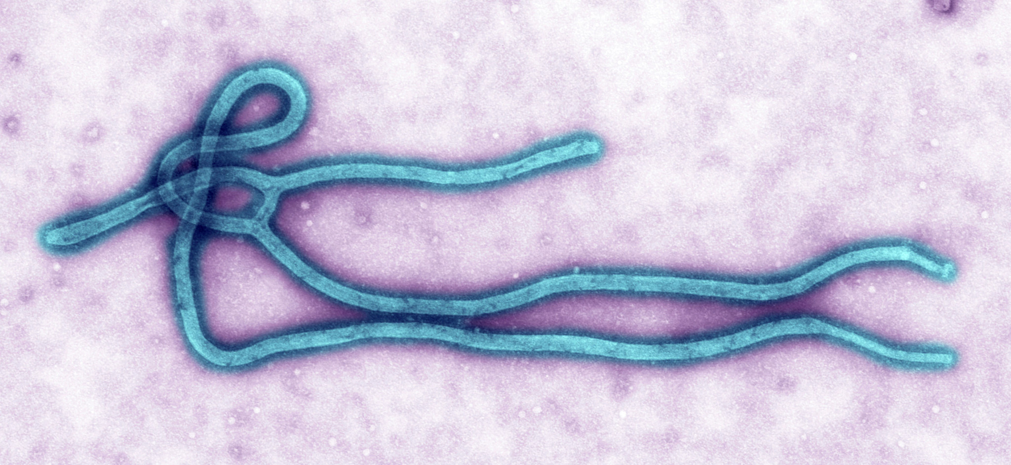 A color-enhanced transmission electron micrograph showing the characteristic long, filament-like structure of an Ebola virus particle, curved and looped against a textured purple background.