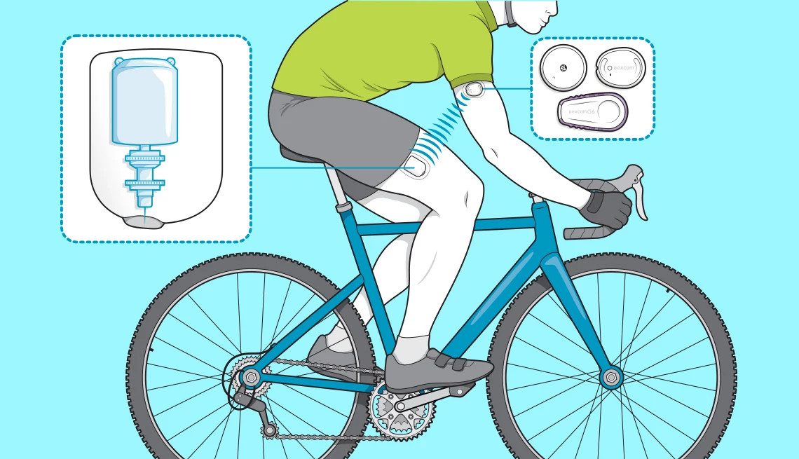 Illustration of a person on a bicycle wearing a continuous glucose monitor (CGM) and an automated insulin pump, with diagrams showing how the devices transmit data and deliver insulin